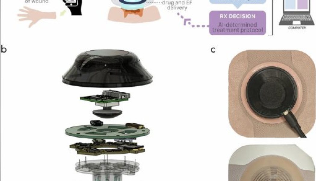 Smart device uses AI and bioelectronics to speed up wound healing process